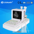 Laptop-tragbarer Ultraschall-Scan-Maschinen-Laptop-Diagnose-Ultraschall für Schwangerschaft